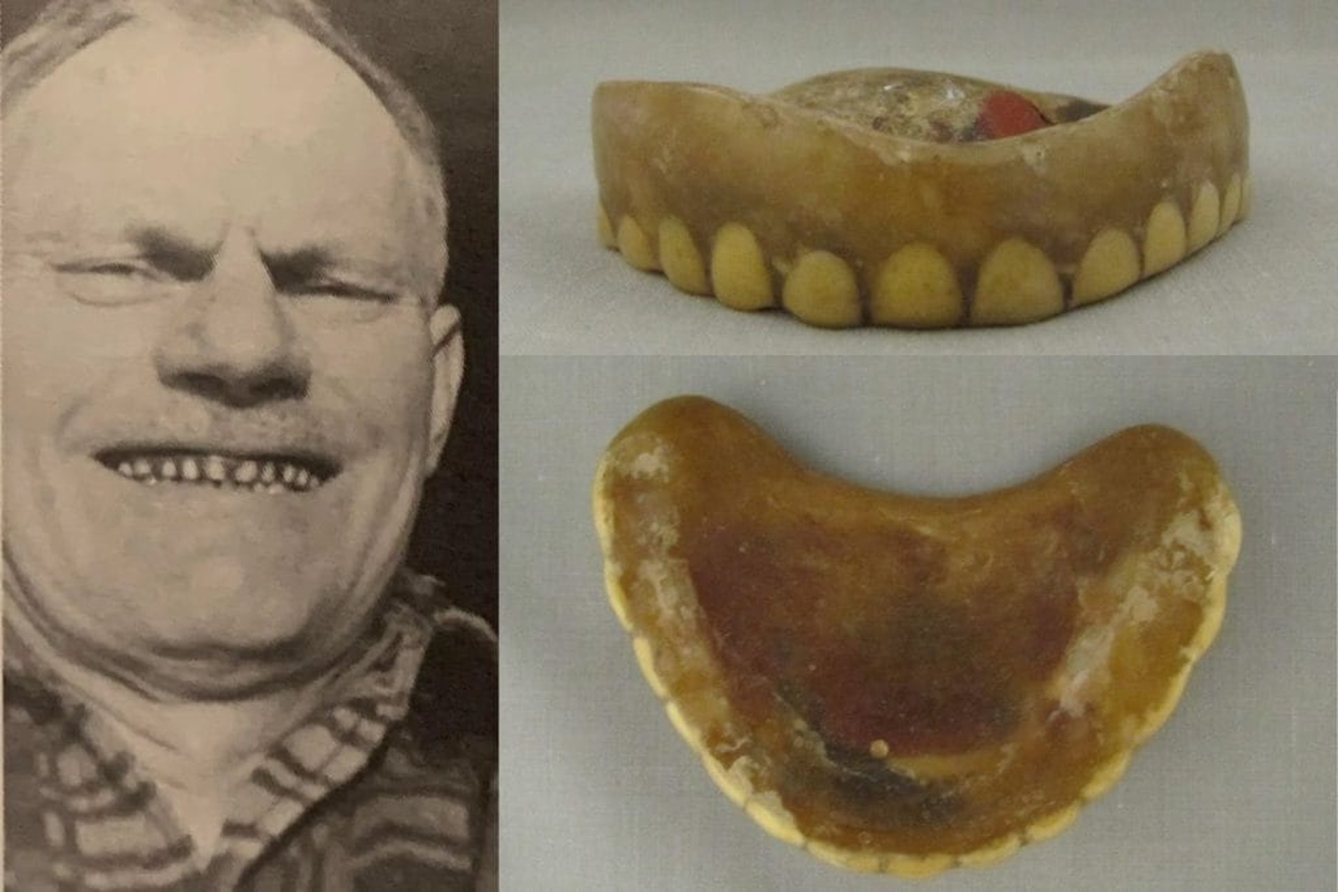francis wharton deer dentures