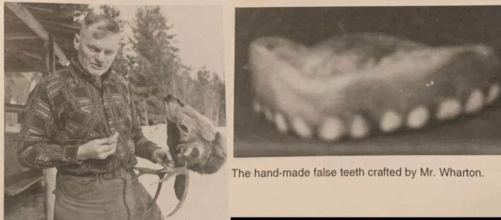 francis wharton deer dentures